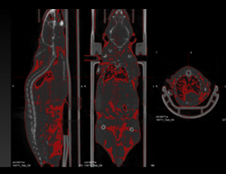 CT Scan Based Fat Segmentation