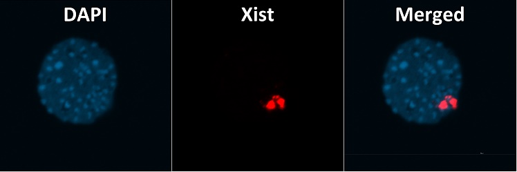 image 1: DAPI image 2: XIST image 3: MERGED