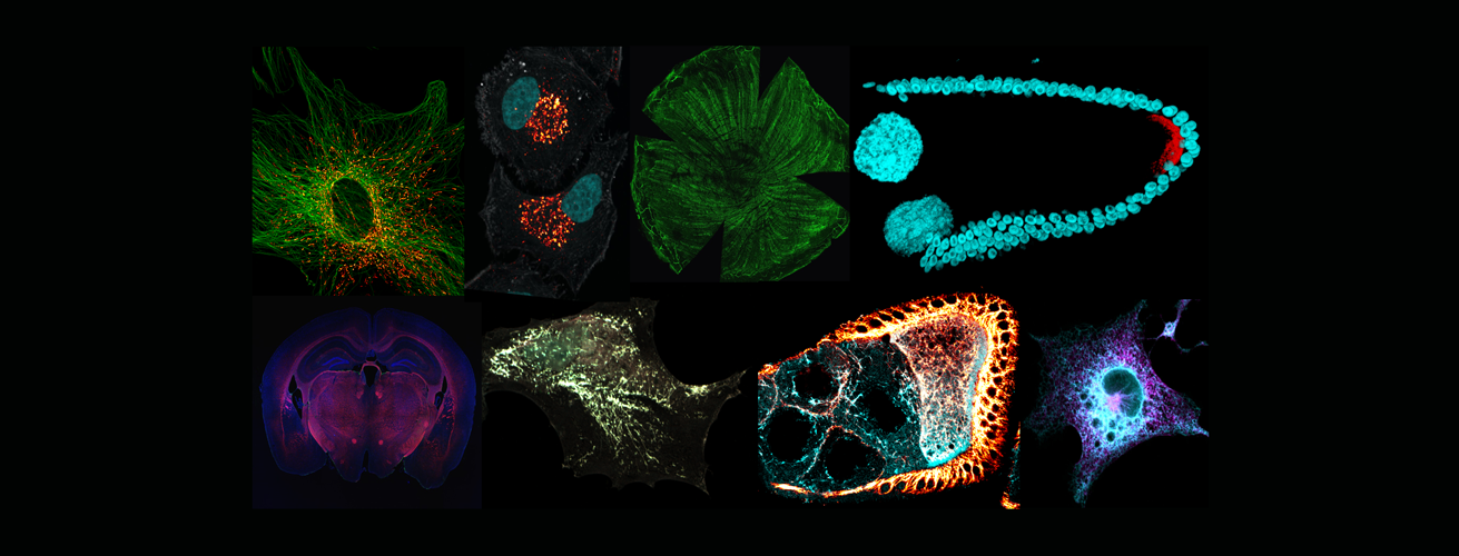 Promo images of cell imaging taken in CIC