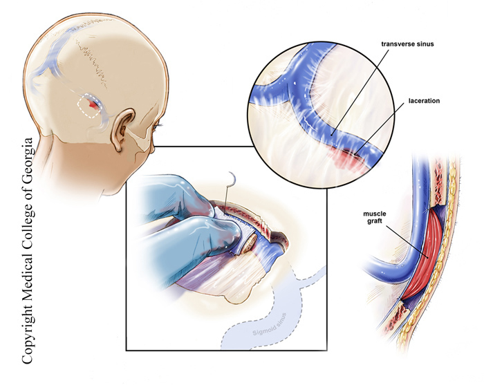 neuro illustration