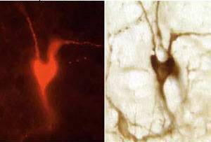 Heart Shaped Brain Cell - Dr. Ann Schreihofer Research Image