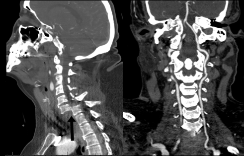 NeuroImage1