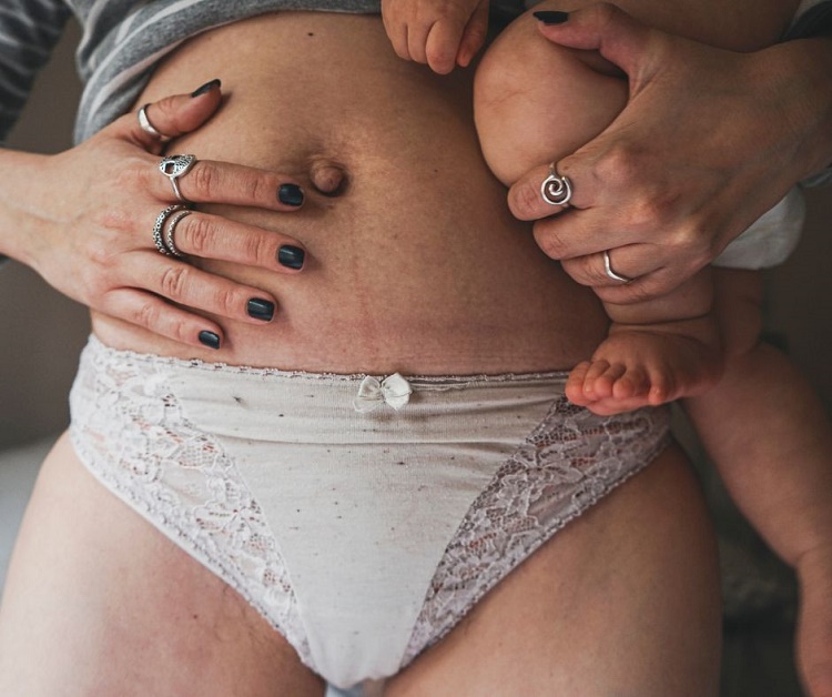 Mother's postpartum belly and baby's feet