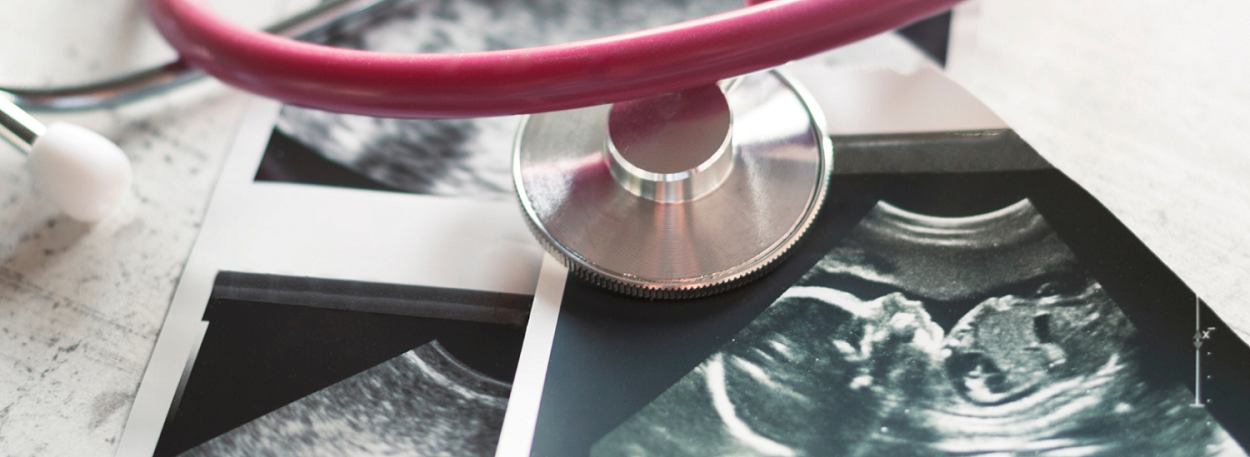 stethoscope and ultrasound pictures of a baby on a table